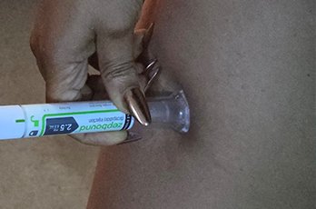 What Is Tirzepatide and How Does It Work for Weight Loss